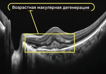 Снимок Velite C3000, снимок 18