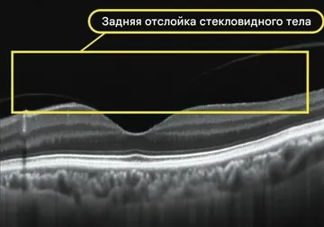 Снимок Velite C3000, снимок 19