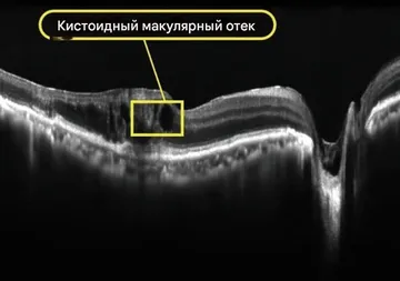 Снимок Velite C3000, снимок 20